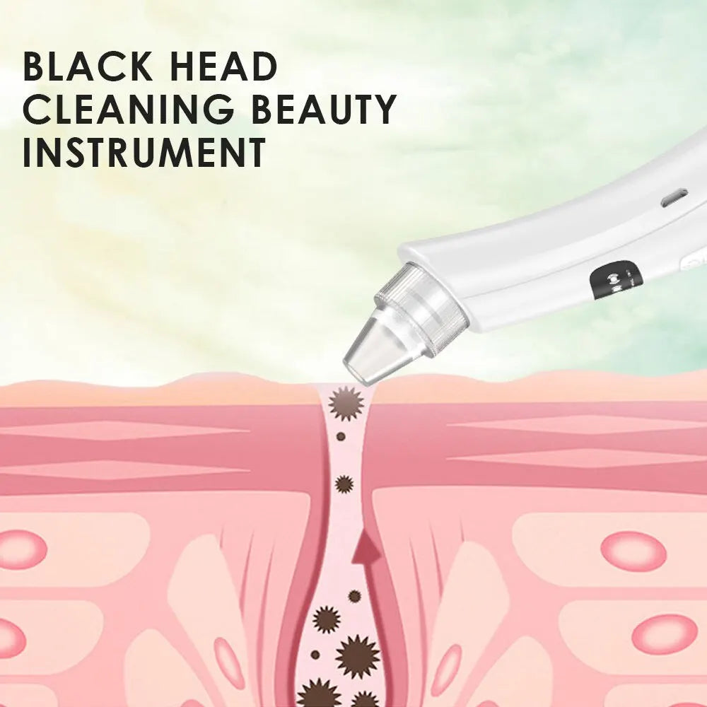 Blackhead Removing Suction Device