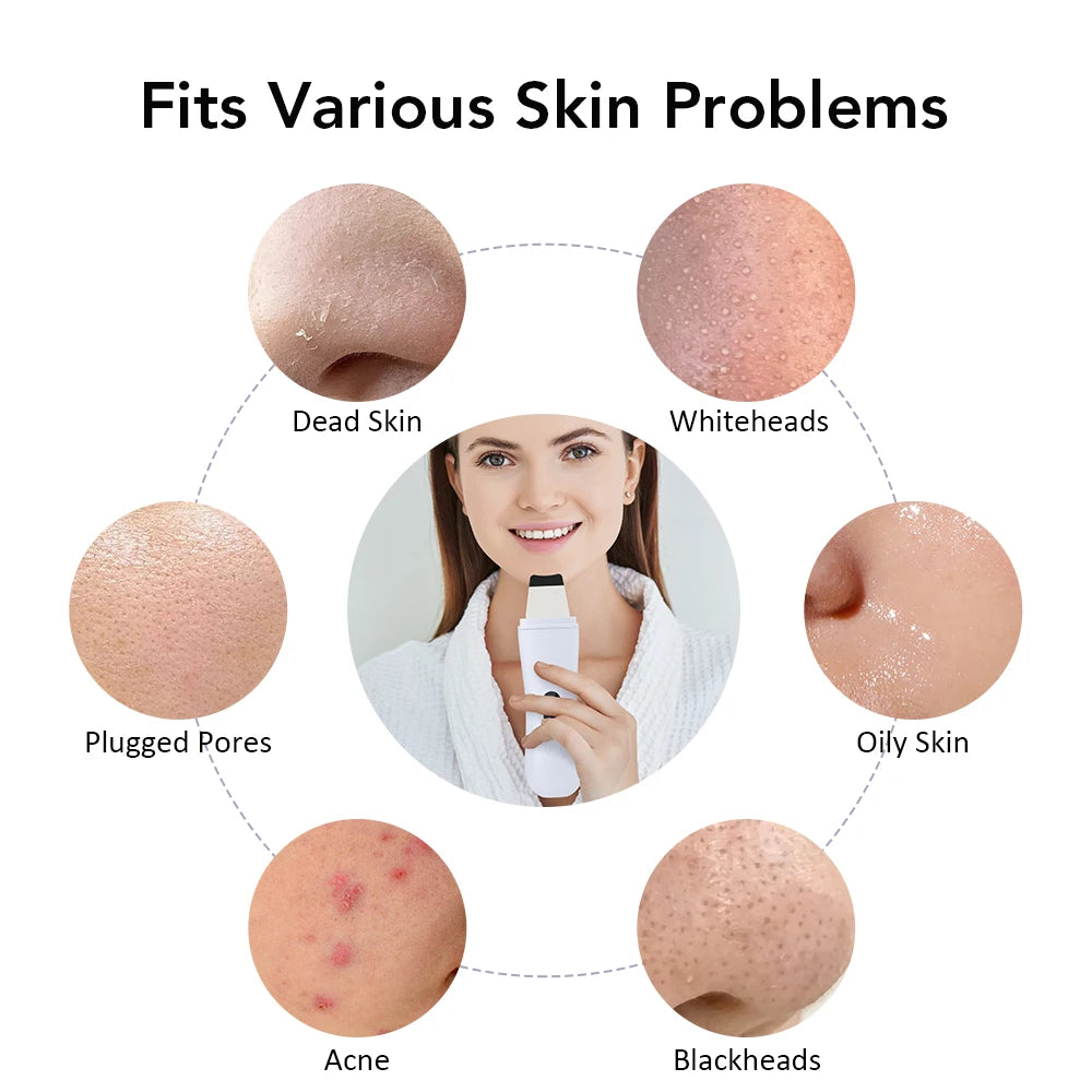 Ultrasonic Skin Spatula Device