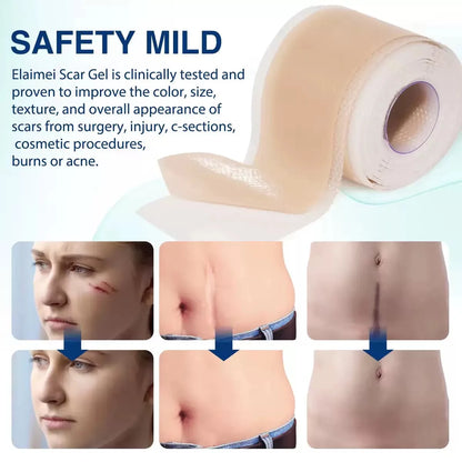Silicone Scar Sheet